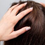 z29877279IER,Skora-glowy